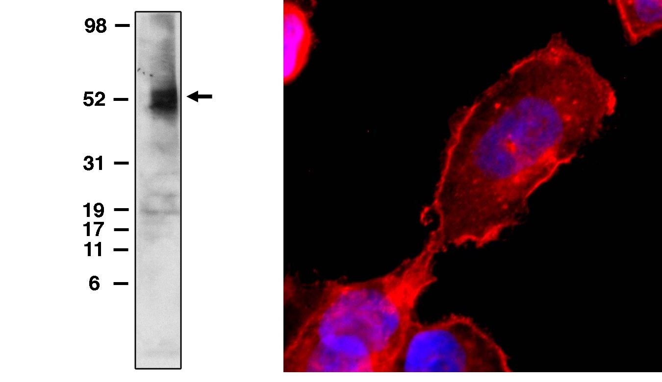 "Western blot analysis
using EDG6 (S1P4) monoclonal antibody (X1533M) on cell lysate transfected with EDG6 (S1P4) protein (cat. no. X1311C) at 5 μg/ml.

Immunofluorescence on transiently transfected CHO cells. Developed with Cy5 anti-mouse, nuclei are stained with DAPI."